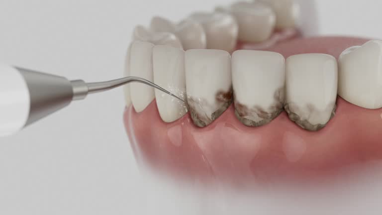 Reliable Dental Implants contractor in Tuckerman, AR by Smile Center Dentistry